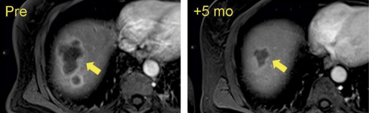 Talk's display image