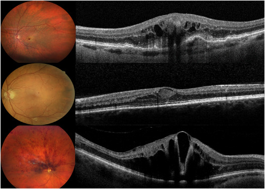 Talk's display image