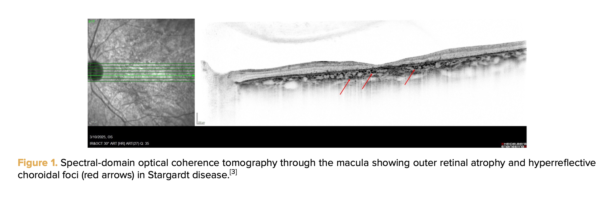 Talk's display image